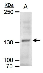 Anti-MYT1 antibody used in Western Blot (WB). GTX128188