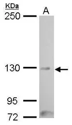 Anti-MYT1 antibody used in Western Blot (WB). GTX128188