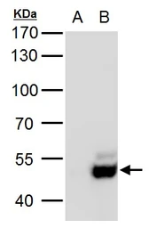 Anti-USP3 antibody used in Western Blot (WB). GTX128238