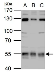 Anti-USP3 antibody used in Western Blot (WB). GTX128238