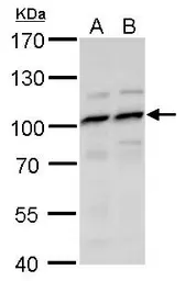 Anti-MYSM1 antibody used in Western Blot (WB). GTX128254