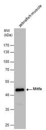 Anti-Mitfa antibody used in Western Blot (WB). GTX128263