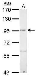 Anti-Pcdh8 antibody used in Western Blot (WB). GTX128328