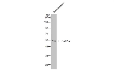 Anti-Gata1a antibody used in Western Blot (WB). GTX128333
