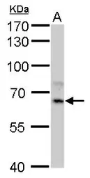 Anti-Cyp1a antibody used in Western Blot (WB). GTX128377