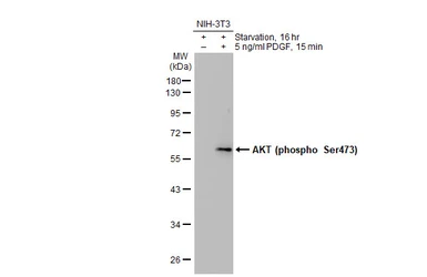 Anti-AKT (phospho Ser473) antibody used in Western Blot (WB). GTX128414