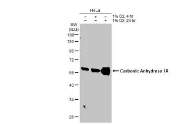 Anti-Carbonic Anhydrase IX antibody used in Western Blot (WB). GTX128428