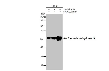 Anti-Carbonic Anhydrase IX antibody used in Western Blot (WB). GTX128428