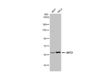 Anti-AKT2 antibody used in Western Blot (WB). GTX128458