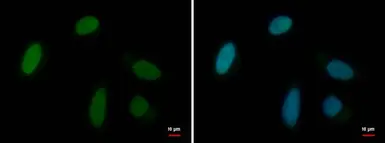 Anti-MRG15 antibody used in Immunocytochemistry/ Immunofluorescence (ICC/IF). GTX128495