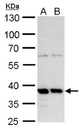Anti-MRG15 antibody used in Western Blot (WB). GTX128495