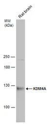 Anti-KDM4A antibody used in Western Blot (WB). GTX128497