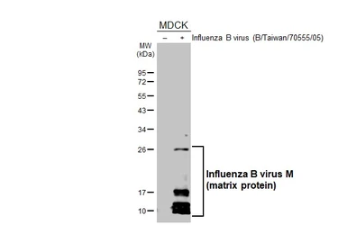 Anti-Influenza B virus M (matrix protein) antibody used in Western Blot (WB). GTX128537