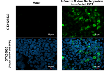 Anti-Influenza B virus Nucleoprotein antibody used in Immunocytochemistry/ Immunofluorescence (ICC/IF). GTX128539