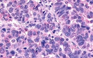 Anti-MRGX1 antibody used in IHC (Paraffin sections) (IHC-P). GTX12856