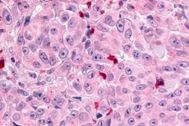 Anti-MRGX1 antibody used in IHC (Paraffin sections) (IHC-P). GTX12856