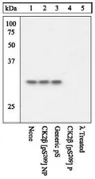 Anti-Casein Kinase 2 beta (phospho Ser209) antibody used in Western Blot (WB). GTX12861