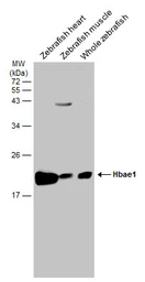 Anti-Hbae1 antibody used in Western Blot (WB). GTX128636
