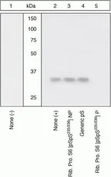Anti-RPS6 (phospho Ser235/236) antibody used in Western Blot (WB). GTX12864