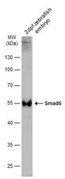 Anti-Smad5 antibody used in Western Blot (WB). GTX128642