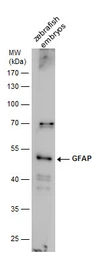 Anti-Gfap antibody used in Western Blot (WB). GTX128644