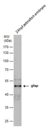 Anti-Gfap antibody used in Western Blot (WB). GTX128645