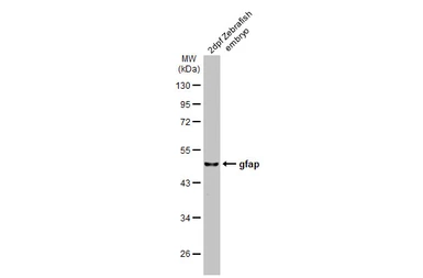Anti-Gfap antibody used in Western Blot (WB). GTX128645