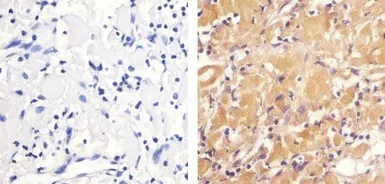 Anti-ZAP70 (phospho Tyr292) antibody used in IHC (Paraffin sections) (IHC-P). GTX12868