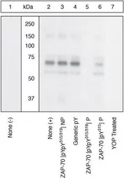 Anti-ZAP70 (phospho Tyr315/Tyr319) antibody used in Western Blot (WB). GTX12869