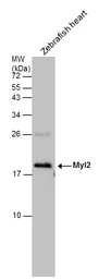 Anti-Myl2 antibody used in Western Blot (WB). GTX128816