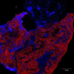 Anti-Myl2 antibody used in Immunohistochemistry (IHC). GTX128816