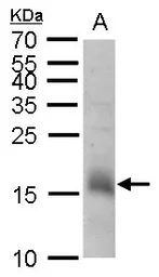 Anti-CHAC2 antibody used in Western Blot (WB). GTX128819