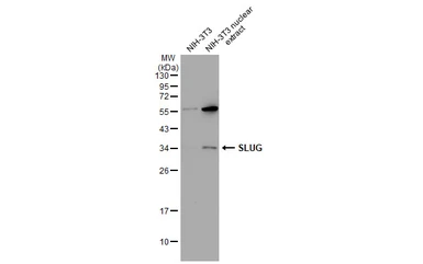 Anti-SLUG antibody used in Western Blot (WB). GTX128874