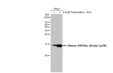 Anti-Histone H3K18ac (Acetyl Lys18) antibody used in Western Blot (WB). GTX128943