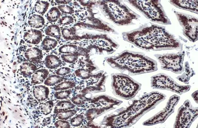 Anti-Histone H3K18ac (Acetyl Lys18) antibody used in IHC (Paraffin sections) (IHC-P). GTX128943