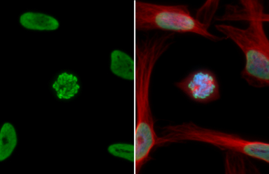 Anti-Histone H3K18ac (Acetyl Lys18) antibody used in Immunocytochemistry/ Immunofluorescence (ICC/IF). GTX128943