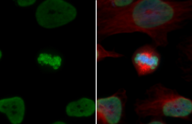 Anti-Histone H3K18ac (Acetyl Lys18) antibody used in Immunocytochemistry/ Immunofluorescence (ICC/IF). GTX128943