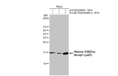 Anti-Histone H3K27ac (Acetyl Lys27) antibody used in Western Blot (WB). GTX128944