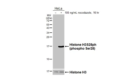 Anti-Histone H3S28ph (phospho Ser28) antibody used in Western Blot (WB). GTX128953