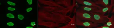 Anti-Histone H4K8ac (acetyl Lys8) antibody used in Immunocytochemistry/ Immunofluorescence (ICC/IF). GTX128957