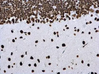 Anti-Histone H4K8ac (acetyl Lys8) antibody used in IHC (Paraffin sections) (IHC-P). GTX128957