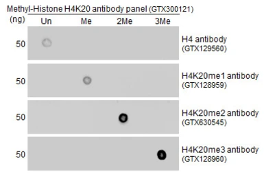 Anti-Histone H4K20me3 (trimethyl Lys20) antibody used in Dot blot (Dot). GTX128960