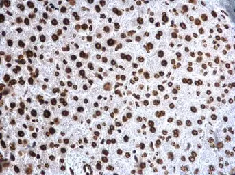 Anti-Histone H4K20me3 (trimethyl Lys20) antibody used in IHC (Paraffin sections) (IHC-P). GTX128960