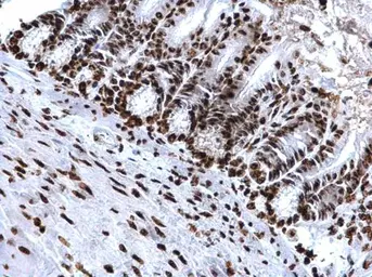 Anti-Histone H4K20me3 (trimethyl Lys20) antibody used in IHC (Paraffin sections) (IHC-P). GTX128960