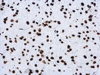 Anti-Histone H4K20me3 (trimethyl Lys20) antibody used in IHC (Paraffin sections) (IHC-P). GTX128960