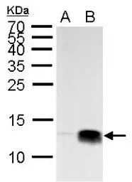 Anti-Histone H4K20me3 (trimethyl Lys20) antibody used in Western Blot (WB). GTX128960