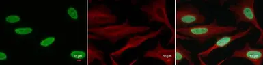 Anti-Histone H2BK20ac (acetyl Lys20) antibody used in Immunocytochemistry/ Immunofluorescence (ICC/IF). GTX128962