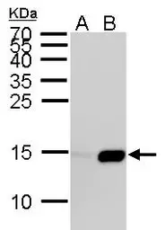 Anti-Histone H2BK5ac (acetyl Lys5) antibody used in Western Blot (WB). GTX128963