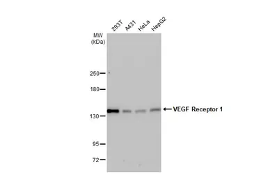 Anti-VEGF Receptor 1 antibody used in Western Blot (WB). GTX128969