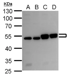Anti-RUVBL2 antibody used in Western Blot (WB). GTX128970